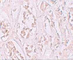 Storkhead Box 2 Antibody - BSA Free, Novus Biologicals 0.1 mg | Buy Online | Novus Biologicals | Fisher Scientific