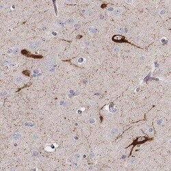 Preprotachykinin-1 Antibody, Novus Biologicals 0.1 mL; Unconjugated:Antibodies,