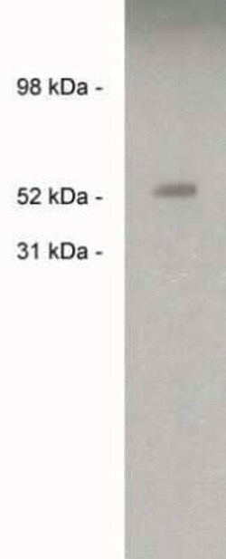 Sulfatase-2/SULF2 Rabbit anti-Human, Polyclonal, Novus Biologicals:Antibodies:Primary