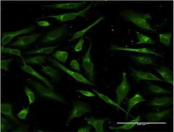 Surfactant Protein A Antibody (4C4), Novus Biologicals 0.1 mg | Buy Online | Novus Biologicals | Fisher Scientific