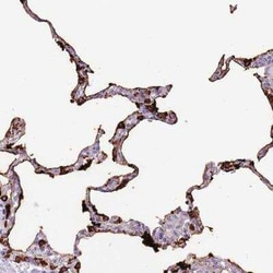 Surfactant Protein A Antibody, Novus Biologicals:Antibodies:Primary Antibodies
