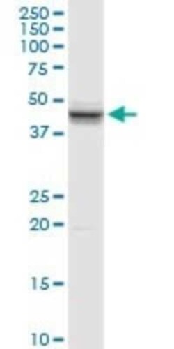 SP-B/Surfactant Protein B Antibody, Novus Biologicals 0.1 mg | Buy Online | Novus Biologicals | Fisher Scientific