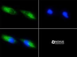 Survivin Antibody (8E2) - Azide and BSA Free, Novus Biologicals 0.1 mL | Buy Online | Novus Biologicals | Fisher Scientific