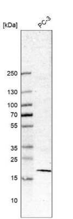 Survivin Antibody (CL12064), Novus Biologicals 25 &mu;g; Unconjugated:Antibodies,
