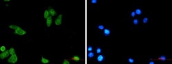 Survivin Antibody (S04-1B1), Novus Biologicals:Antibodies:Primary Antibodies