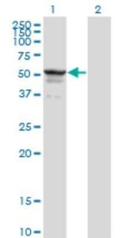 Symplekin Antibody (4C2), Novus Biologicals 0.1 mg | Buy Online | Novus Biologicals | Fisher Scientific
