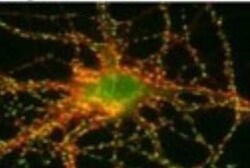 SynGAP Antibody, Novus Biologicals 0.025 mg; Unconjugated:Anticorps, Polyclonal