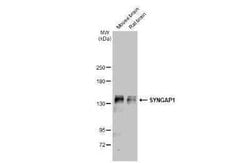 SynGAP Antibody, Novus Biologicals 100 &mu;g; Unconjugated:Antibodies,