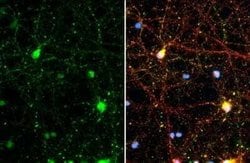 Synapsin II Antibody (GT1446), Novus Biologicals 100 &mu;g | Buy Online | Novus Biologicals | Fisher Scientific