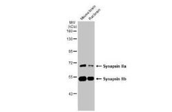 Synapsin II Antibody (GT387), Novus Biologicals 100 &mu;g | Buy Online | Novus Biologicals | Fisher Scientific