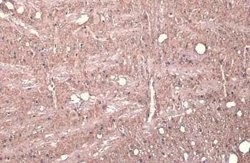 Synapsin II Antibody, Novus Biologicals 100 &mu;g; Unconjugated:Antibodies,