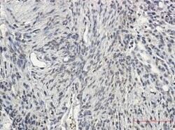 Synapsin II Antibody (S07-0I5), Novus Biologicals:Antibodies:Primary Antibodies
