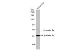 Synapsin II Antibody, Novus Biologicals 100 &mu;g | Buy Online | Bio-Techne | Fisher Scientific