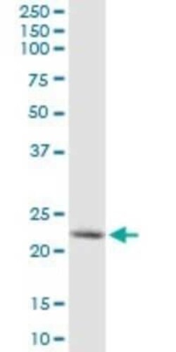 Synaptobrevin homolog YKT6 Antibody (1F8), Novus Biologicals 0.1 mg | Buy Online | Novus Biologicals | Fisher Scientific