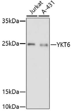 Synaptobrevin homolog YKT6 Antibody - Azide and BSA Free, Novus Biologicals