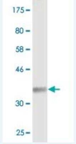 Synaptogyrin 2 Antibody (1G7), Novus Biologicals 0.1 mg | Buy Online | Novus Biologicals | Fisher Scientific