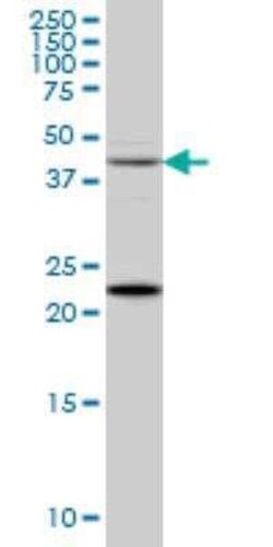 Synaptotagmin 2 Antibody (1G10), Novus Biologicals 0.1 mg | Buy Online | Novus Biologicals | Fisher Scientific