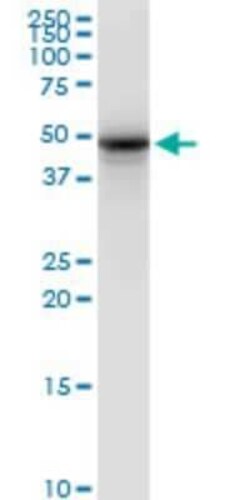 Synaptotagmin 2 Antibody (1G10), Novus Biologicals 0.1 mg | Buy Online | Novus Biologicals | Fisher Scientific