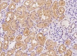 Syndecan-1/CD138 Rabbit anti-Human, Clone: 160, Novus Biologicals:Antibodies:Primary