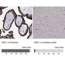 Syndecan-1/CD138 Rabbit anti-Human, Polyclonal, Novus Biologicals 100 &mu;g;