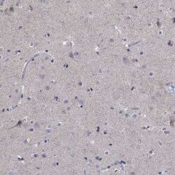 Syndecan-1/CD138 Rabbit anti-Human, Polyclonal, Novus Biologicals 100 &mu;g;