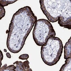 Syndecan-1/CD138 Rabbit anti-Human, Polyclonal, Novus Biologicals 100 &mu;g;