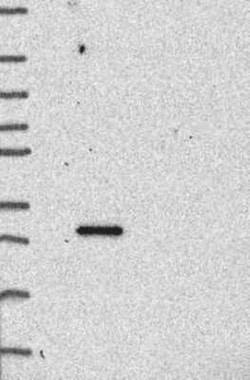 Syndecan-1/CD138 Rabbit anti-Human, Polyclonal, Novus Biologicals 100 &mu;g;