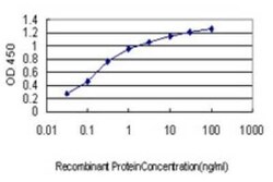 Synphilin-1 Antibody (2A8), Novus Biologicals 0.1 mg | Buy Online | Novus Biologicals | Fisher Scientific