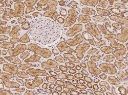 Synphilin-1 Antibody, Novus Biologicals 100 &mu;g | Buy Online | Novus Biologicals | Fisher Scientific