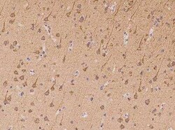 Synphilin-1 Antibody, Novus Biologicals 100 &mu;g | Buy Online | Novus Biologicals | Fisher Scientific