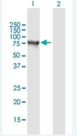 Synphilin-1 Antibody, Novus Biologicals 50 &mu;g | Buy Online | Novus Biologicals | Fisher Scientific