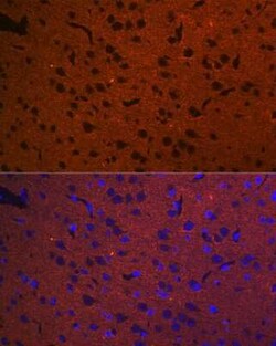 Syntaxin 1A Rabbit anti-Human, Mouse, Rat, Clone: 2B2F10, Novus Biologicals 20 &mu;g | Buy Online | Bio-Techne | Fisher Scientific