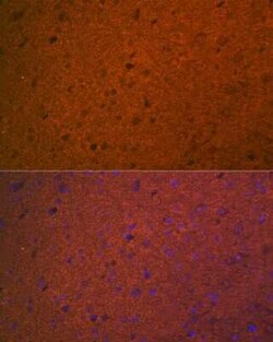 Syntaxin 1A Rabbit anti-Human, Mouse, Rat, Clone: 2B2F10, Novus Biologicals 20 &mu;g | Buy Online | Bio-Techne | Fisher Scientific