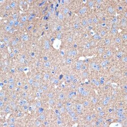 Syntaxin 1A Rabbit anti-Human, Mouse, Rat, Clone: 2B2F10, Novus Biologicals 20 &mu;g | Buy Online | Bio-Techne | Fisher Scientific