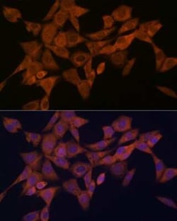 Syntaxin 4 Rabbit anti-Human, Mouse, Rat, Clone: 8F3P7, Novus Biologicals 100 &mu;g | Buy Online | Novus Biologicals | Fisher Scientific