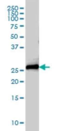 Novus Biologicals Syntaxin 8 Antibody (2H1-1D11), Novus Biologicals 0.1 mg | Buy Online | Novus Biologicals&trade; | Fisher Scientific