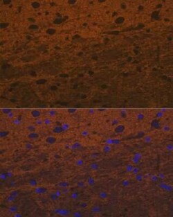 Syntaxin Rabbit anti-Human, Mouse, Rat, Clone: 7D9V8, Novus Biologicals 20 &mu;g | Buy Online | Novus Biologicals | Fisher Scientific