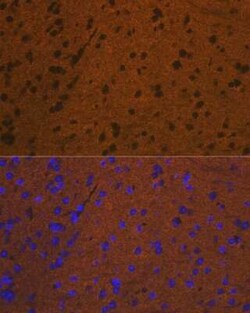 Syntaxin Rabbit anti-Human, Mouse, Rat, Clone: 7D9V8, Novus Biologicals 20 &mu;g | Buy Online | Novus Biologicals | Fisher Scientific