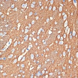 Syntaxin Rabbit anti-Human, Mouse, Rat, Clone: 7D9V8, Novus Biologicals 20 &mu;g | Buy Online | Novus Biologicals | Fisher Scientific