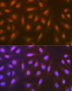 Syntenin 1 Rabbit anti-Human, Mouse, Rat, Clone: 3J5O6, Novus Biologicals:Antibodies:Primary