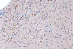 Syntenin 1 Rabbit anti-Human, Mouse, Rat, Clone: 3J5O6, Novus Biologicals:Antibodies:Primary