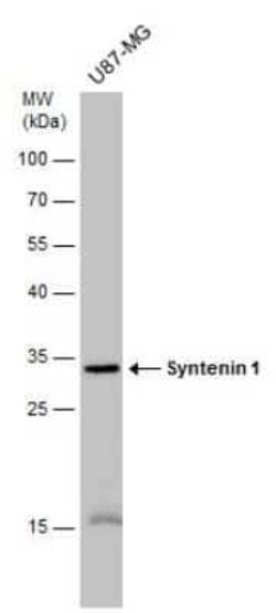 Syntenin 1 Antibody (GT1523), Novus Biologicals 100 &mu;g | Buy Online | Novus Biologicals | Fisher Scientific