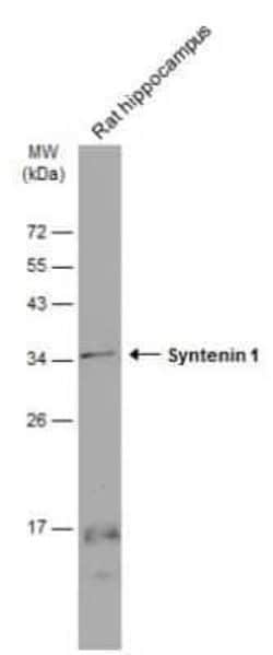 Syntenin 1 Antibody (GT1523), Novus Biologicals 100 &mu;g | Buy Online | Novus Biologicals | Fisher Scientific