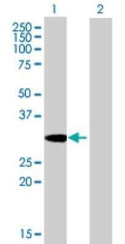 Syntenin 1 Antibody, Novus Biologicals 0.05 mg | Buy Online | Novus Biologicals | Fisher Scientific