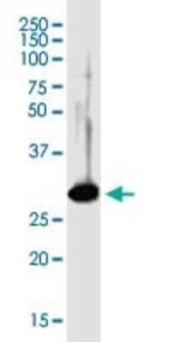 Syntenin 1 Antibody, Novus Biologicals 0.05 mg | Buy Online | Novus Biologicals | Fisher Scientific