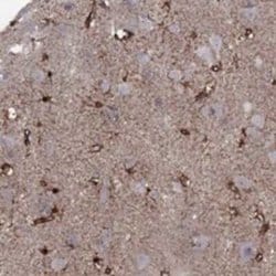 Syntrophin Rabbit anti-Human, Polyclonal, Novus Biologicals 25 &mu;g; Unconjugated:Antibodies,