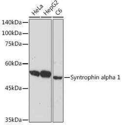 Syntrophin alpha 1 Rabbit anti-Human, Mouse, Rat, Clone: 3B10G10, Novus
