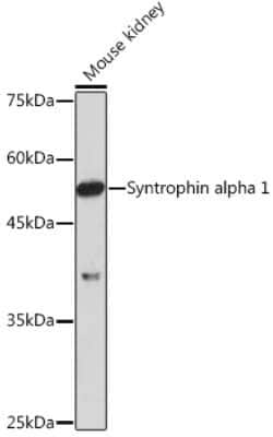 Syntrophin alpha 1 Rabbit anti-Human, Mouse, Rat, Clone: 3B10G10, Novus
