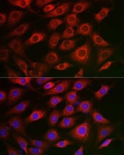 Syntrophin alpha 1 Rabbit anti-Human, Mouse, Rat, Polyclonal, Novus Biologicals 20 &mu;g | Buy Online | Novus Biologicals | Fisher Scientific