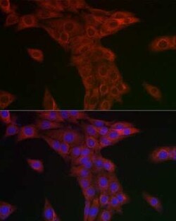 Syntrophin alpha 1 Rabbit anti-Human, Mouse, Rat, Polyclonal, Novus Biologicals 20 &mu;g | Buy Online | Novus Biologicals | Fisher Scientific